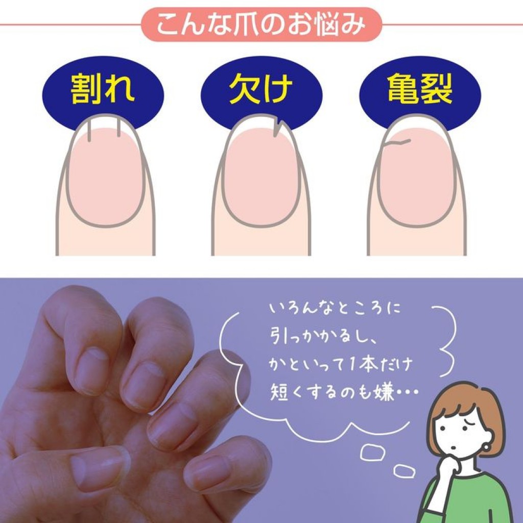 nail-repair04.jpg