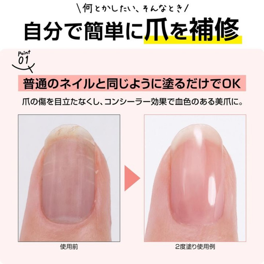 nail-repair07.jpg